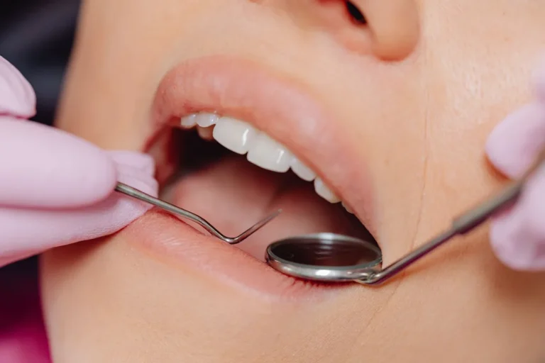 dental hygienist cleaning teeth