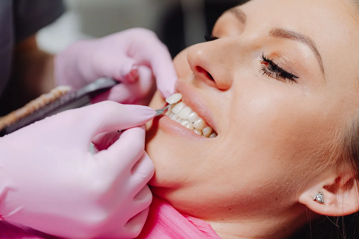 fluoride varnish application