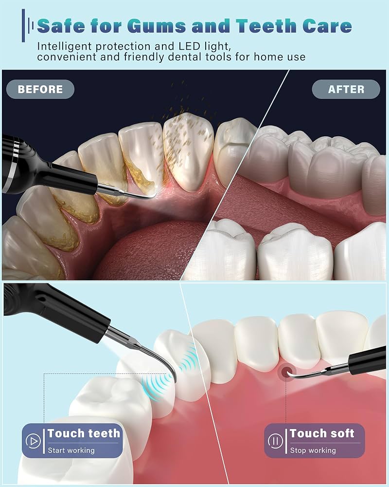 How To Do A Dental Cleaning At Home